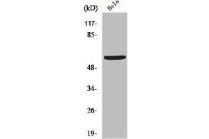 Western Blot analysis of Hela cells using GM2/GD2 synthase Polyclonal Antibody (B4GALNT1 Antikörper  (Internal Region))