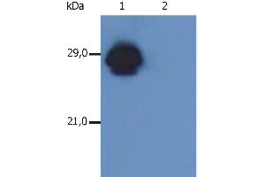 Western Blotting analysis of MHC Class II in whole cell lysate of RAJI human Burkitt lymphoma cell line using anti-human HLA-DR+DP (MEM-136). (HLA-DP/DR Antikörper  (Biotin))