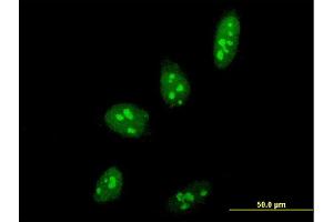 Immunofluorescence of monoclonal antibody to PELP1 on HeLa cell. (PELP1 Antikörper  (AA 337-410))