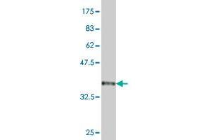 Western Blot detection against Immunogen (36. (BTG2 Antikörper  (AA 59-158))
