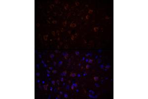 Immunofluorescence analysis of Rat brain using CHAT antibody (ABIN7266344) at dilution of 1:100 (40x lens). (Choline Acetyltransferase Antikörper  (AA 331-630))