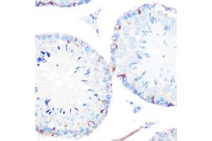 Immunohistochemistry (IHC) image for anti-Junction Plakoglobin (JUP) antibody (ABIN1683043)