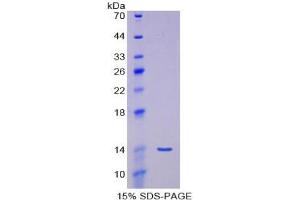 SDS-PAGE of Protein Standard from the Kit (Highly purified E. (MSTN CLIA Kit)