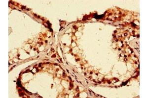 Immunohistochemistry (IHC) image for anti-ATP-Binding Cassette, Sub-Family G (WHITE), Member 1 (ABCG1) (AA 84-222) antibody (ABIN7144930)