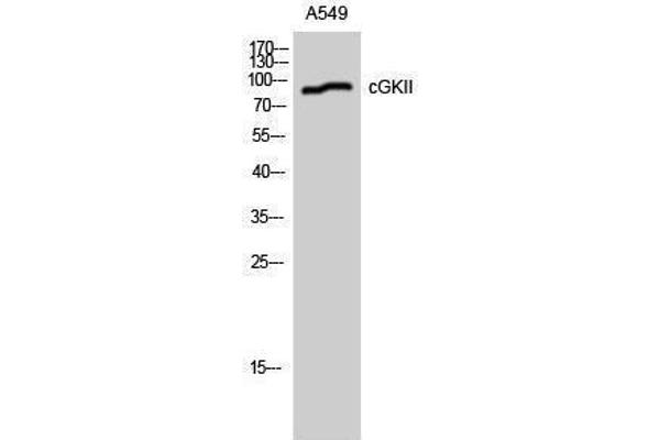 PRKG2 Antikörper  (Ser363, Thr359)
