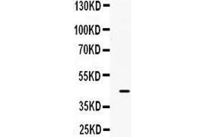 B3GNT8 Antikörper  (C-Term)