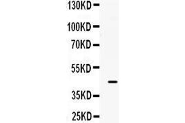 B3GNT8 Antikörper  (C-Term)