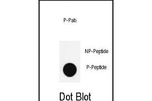 Dot blot analysis of anti-Phospho-Nanog- Antibody (ABIN390033 and ABIN2839783) on nitrocellulose membrane. (Nanog Antikörper  (pSer285))
