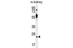 TTC9B Antibody (C-term) western blot analysis in mouse kidney tissue lysates (35 µg/lane). (TTC9B Antikörper  (C-Term))