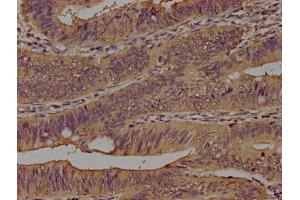 Immunohistochemistry (IHC) image for anti-CD14 (CD14) (AA 20-345) antibody (ABIN7160185)