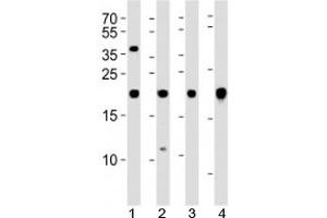 Western blot analysis of lysate from 1) U-87 MG, 2) SK-N-MC cell line, 3) human heart and 4) mouse heart tissue using HES5 antibody at 1:1000. (HES5 Antikörper)