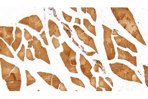 Immunohistochemistry (IHC) image for anti-Adiponectin Receptor 2 (ADIPOR2) (AA 1-147) antibody (ABIN7431158)