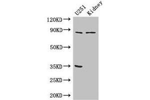Western Blot Positive WB detected in: U251 whole cell lysate, Mouse kidney tissue All lanes: RPS6KA4 antibody at 3 μg/mL Secondary Goat polyclonal to rabbit IgG at 1/50000 dilution Predicted band size: 86, 85 kDa Observed band size: 86 kDa (MSK2 Antikörper  (AA 237-393))