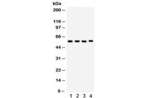 Western blot testing of 1) rat lung, 2) mouse lung, 3) human placenta, 4) Jurkat lysate with CYP1A1 antibody. (CYP1A1 Antikörper  (AA 183-320))