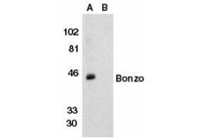 Western blot analysis of Bonzo in human spleen tissue lysate in the absence (lane A) or presence (lane B) of peptide with AP30160PU-N Bonzo antibody (NT2) at 1/500 dilution. (CXCR6 Antikörper  (N-Term))