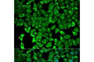 Immunofluorescence analysis of HeLa cells using PSMD2 Polyclonal Antibody (PSMD2 Antikörper)