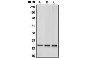 Western blot analysis of DJ-1 expression in HeLa (A), HEK293T (B), Jurkat (C) whole cell lysates. (PARK7/DJ1 Antikörper  (Center))