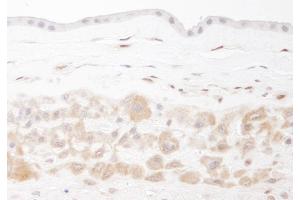 Immunohistochemistry (IHC) image for anti-Nicotinamide phosphoribosyltransferase (NAMPT) (AA 400-450) antibody (ABIN7448717)