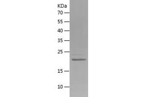 Western Blotting (WB) image for ADP-Ribosylation Factor 5 (ARF5) (AA 1-180) protein (His tag) (ABIN7121734)