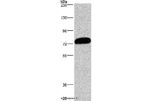 Western blot analysis of PC3 cell, using CDCP1 Polyclonal Antibody at dilution of 1:1100 (CDCP1 Antikörper)