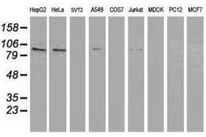 Image no. 3 for anti-Protein Kinase C, epsilon (PRKCE) antibody (ABIN1500235) (PKC epsilon Antikörper)