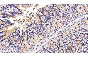 Immunohistochemistry (IHC) image for anti-Mucin 2, Oligomeric Mucus/gel-Forming (MUC2) (AA 27-110) antibody (ABIN7429040)