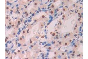 Immunohistochemistry (IHC) image for anti-Amyloid beta 1-42 (Abeta 1-42) antibody (ABIN7427870)