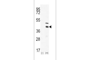 Western blot analysis of DOK4 using DOK4 Antibody using 293 cell lysates (2 ug/lane) either nontransfected (Lane 1) or transiently transfected with the DOK4 gene (Lane 2). (DOK4 Antikörper  (C-Term))