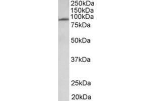 AP31934PU-N MFSD6 antibody staining of Human Heart lysate at 1 µg/ml (35µg protein in RIPA buffer). (MFSD6 Antikörper  (Extracellular Domain))