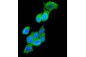 IF analysis of Cytokeratin 19 using anti-Cytokeratin 19 antibody (ABIN3043288).