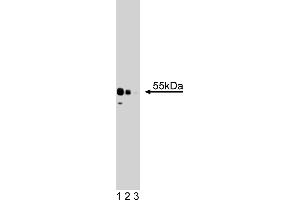 Western Blotting (WB) image for anti-X-Ray Repair Complementing Defective Repair in Chinese Hamster Cells 4 (XRCC4) (AA 53-168) antibody (ABIN968566) (XRCC4 Antikörper  (AA 53-168))