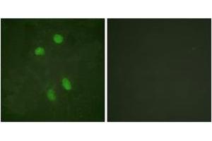 Immunofluorescence (IF) image for anti-Activating Transcription Factor 2 (ATF2) (AA 456-505) antibody (ABIN2888781) (ATF2 Antikörper  (AA 456-505))
