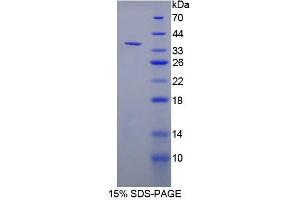 SDS-PAGE analysis of Rat NT5C3 Protein.