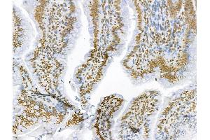 ABIN6259813 and ABIN6273089 at 1/100 staining Rat colon tissue by IHC-P. (AEBP2 Antikörper  (Internal Region))