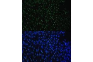 Immunofluorescence (IF) image for anti-DEAD (Asp-Glu-Ala-Asp) Box Polypeptide 50 (DDX50) (AA 1-135) antibody (ABIN6139509)