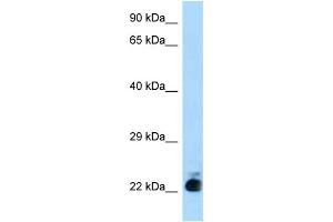 WB Suggested Anti-Slc31a1 Antibody Titration: 1. (SLC31A1 Antikörper  (N-Term))