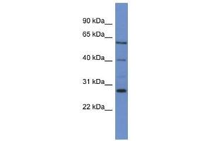 Western Blot showing CYP24A1 antibody used at a concentration of 1-2 ug/ml to detect its target protein. (CYP24A1 Antikörper  (C-Term))