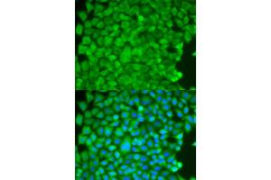 Immunofluorescence analysis of HeLa cells using SGCE antibody. (SGCE Antikörper)