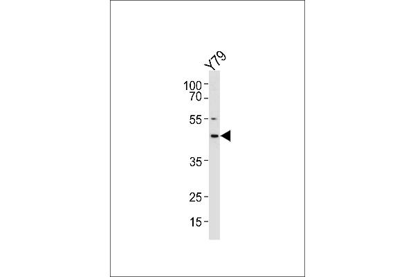 RDH10 Antikörper  (AA 106-135)
