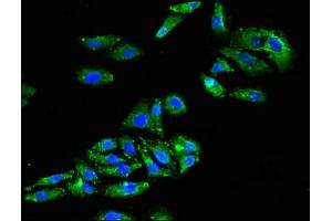 Immunofluorescent analysis of HepG2 cells using ABIN7153601 at dilution of 1:100 and Alexa Fluor 488-congugated AffiniPure Goat Anti-Rabbit IgG(H+L) (GJA8 Antikörper  (AA 286-432))