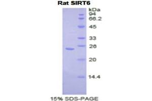 SDS-PAGE analysis of Rat Sirtuin 6 Protein. (SIRT6 Protein)