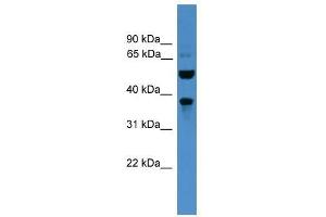 Western Blot showing BEST3 antibody used at a concentration of 1-2 ug/ml to detect its target protein. (Bestrophin 3 Antikörper  (C-Term))