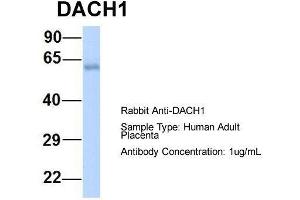Host:  Rabbit  Target Name:  DACH1  Sample Type:  Human Adult Placenta  Antibody Dilution:  1. (DACH1 Antikörper  (N-Term))
