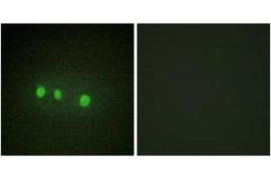 Immunofluorescence analysis of HepG2 cells, using ZIC1/2/3/4/5 Antibody. (ZIC1/2/3 Antikörper  (AA 281-330))