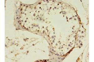 Immunohistochemistry (IHC) image for anti-Squamous Cell Carcinoma Antigen Recognized By T Cells 3 (SART3) (AA 600-900) antibody (ABIN7170663)