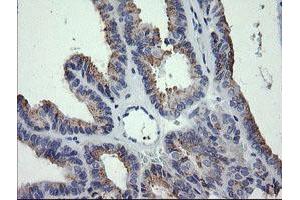Image no. 3 for anti-Cancer/testis Antigen 1B (CTAG1B) antibody (ABIN1499898) (CTAG1B Antikörper)