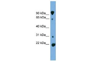 WB Suggested Anti-KLHL2 Antibody Titration: 0. (KLHL2 Antikörper  (Middle Region))