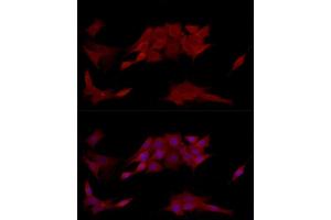Immunofluorescence (IF) image for anti-Protein tyrosine Phosphatase, Non-Receptor Type 2 (PTPN2) (AA 1-353) antibody (ABIN3022585)