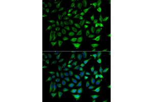 Immunofluorescence analysis of HeLa cell using SLC25A20 antibody. (SLC25A20 Antikörper)