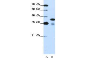 WB Suggested Anti-TARDBP Antibody Titration:  1. (TARDBP Antikörper  (C-Term))
